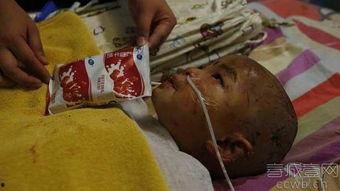 吃瓜被咬掉一块肉视频,网友直呼太真实 第2张 吃瓜被咬掉一块肉视频,网友直呼太真实 第2张